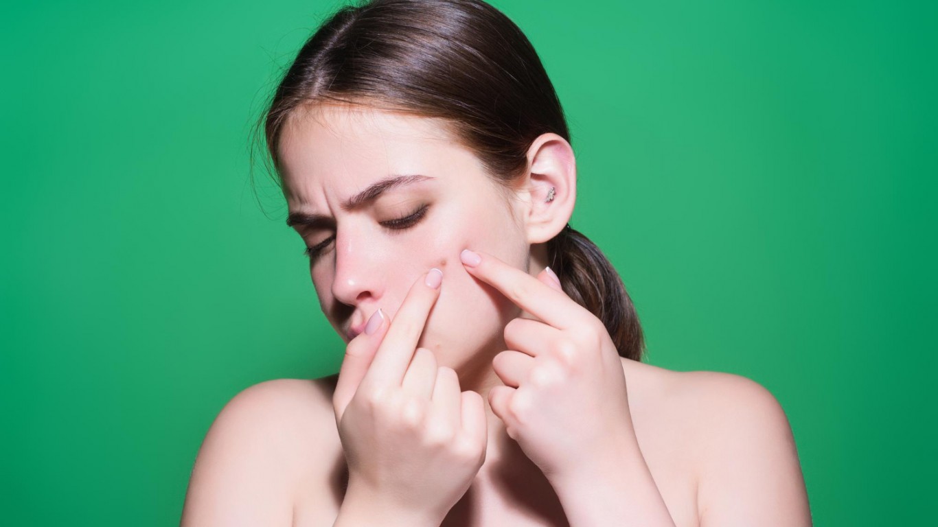 Acne i bubljice – kako ih se rešiti? Acne i bubljice – kako ih se rešiti?