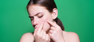 Acne i bubljice – kako ih se rešiti?