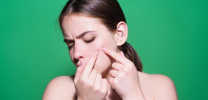 Acne i bubljice – kako ih se rešiti?